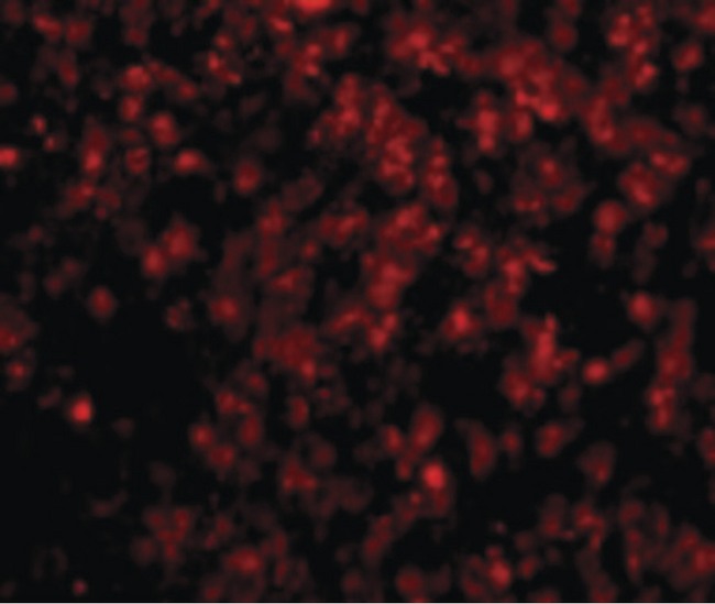 LIPE / HSL Antibody - Immunofluorescence of Lipe in Human Lymph Node cells with Lipe antibody at 20 ug/ml.