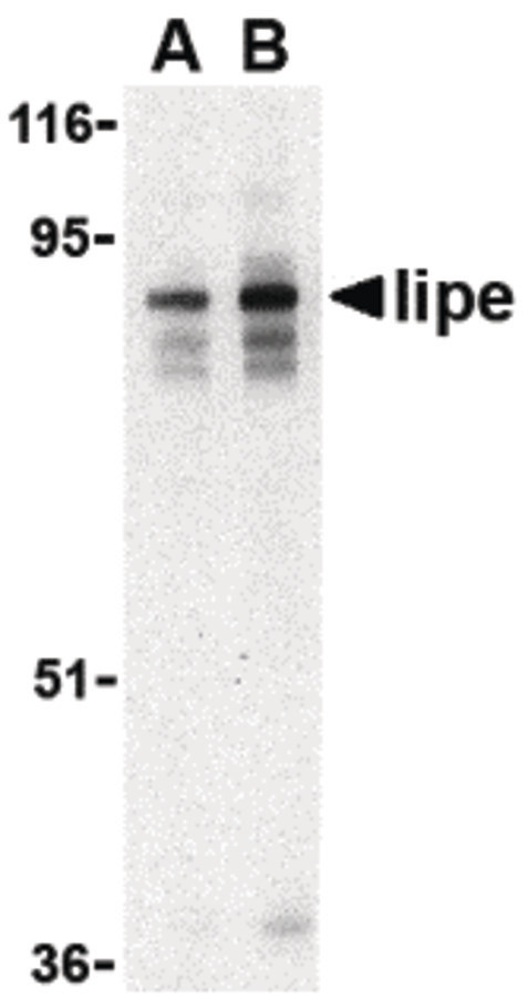 LIPE / HSL Antibody - Western blot of lipe in human lymph node tissue lysate with lipe antibody at (A) 0.5 and (B) 1 ug/ml.