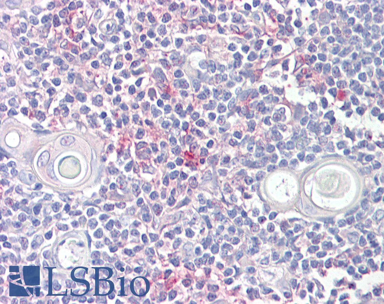 LITAF Antibody - Anti-LITAF antibody IHC of human thymus. Immunohistochemistry of formalin-fixed, paraffin-embedded tissue after heat-induced antigen retrieval. Antibody concentration 6.5 ug/ml.