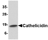 LL37 / Cathelicidin Antibody - Western blot of Cathelicidin in Human spleen tissue lysate with Cathelicidin antibody at 1 ug/ml.