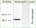LL37 / Cathelicidin Antibody - Rabbit antibody to LL-37. WB on human neutrophil lysate using Rabbit antibody to LL-37at 50 ug/ml concentration. Pre-absorption of the antibody with the immunizing peptide completely abolishes the detected band.
