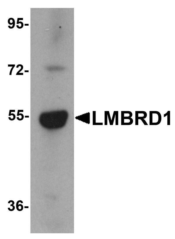 LMBRD1 Antibody - Western blot analysis of LMBRD1 in human brain tissue lysate with LMBRD1 antibody at 1 ug/ml.