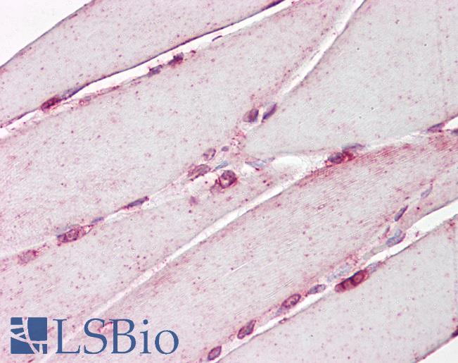 LMNA / Lamin A+C Antibody - Anti-LMNA / Lamin A/C antibody IHC of human skeletal muscle. Immunohistochemistry of formalin-fixed, paraffin-embedded tissue after heat-induced antigen retrieval. Antibody dilution 10 ug/ml.