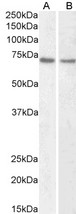 LMNB1 / Lamin B1 Antibody - Goat Anti-Lamin B1 (aa526-537) Antibody (1µg/ml) staining of HeLa (A) and Jurkat (B) nuclear lysate (35µg protein in RIPA buffer). Primary incubation was 1 hour. Detected by chemiluminescencence.