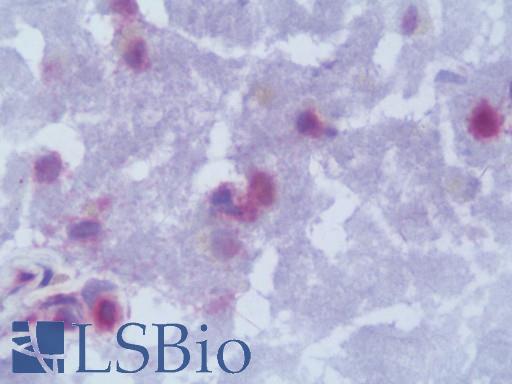 LMNB2 / Lamin B2 Antibody - IHC with Lamin B2 antibody on frozen human brain.