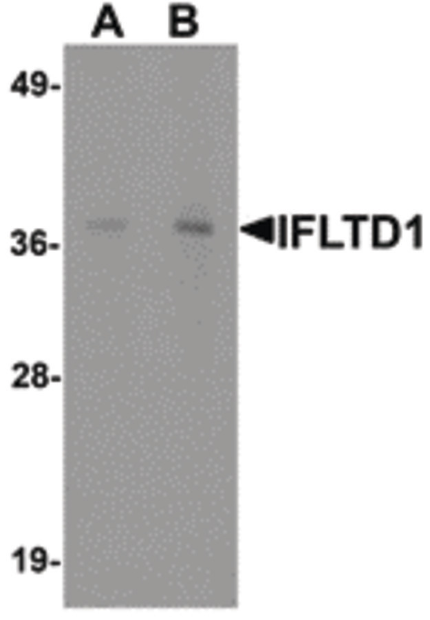 LMNTD1 / IFLTD1 Antibody - Western blot of IFLTD1 in rat liver tissue lysate with IFLTD1 antibody at (A) 1 and (B) 2 ug/ml.