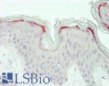 LMO7 Antibody - Human Skin: Formalin-Fixed, Paraffin-Embedded (FFPE)