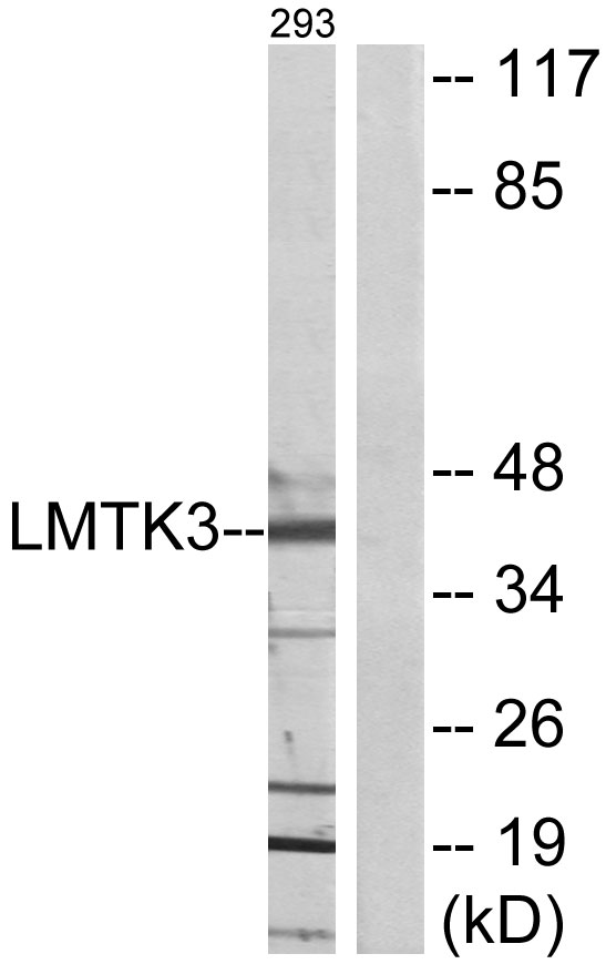 LMTK3 Antibody - Western blot analysis of lysates from 293 cells, using LMTK3 Antibody. The lane on the right is blocked with the synthesized peptide.