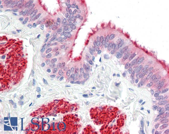 LMX1A Antibody - Anti-LMX1A antibody IHC staining of human lung, bronchiole. Immunohistochemistry of formalin-fixed, paraffin-embedded tissue after heat-induced antigen retrieval.