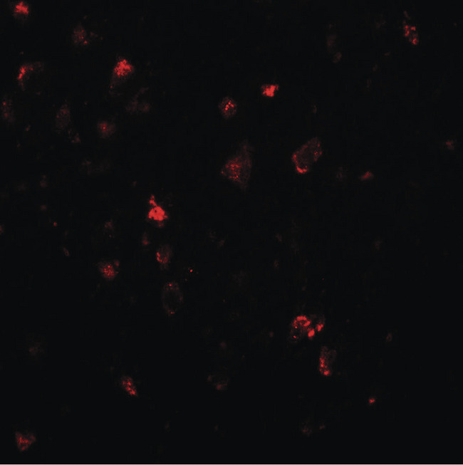 LMX1A Antibody - Immunofluorescence of LMX1A in human brain tissue with LMX1A antibody at 20 ug/ml.