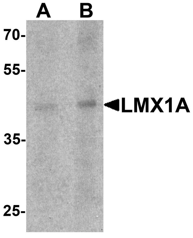 LMX1A Antibody - Western blot analysis of LMX1A in rat brain tissue lysate with LMX1A antibody at (A) 1 and (B) 2 ug/ml.