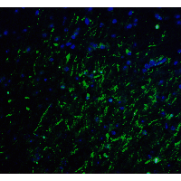 LMX1A Antibody - Immunofluorescence of LMX1A in mouse brain tissue with LMX1A Antibodyat 20 µg/mL.