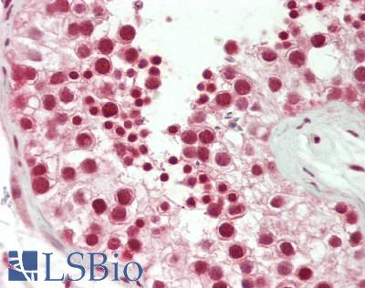 LMX1B Antibody - Human Testis: Formalin-Fixed, Paraffin-Embedded (FFPE)