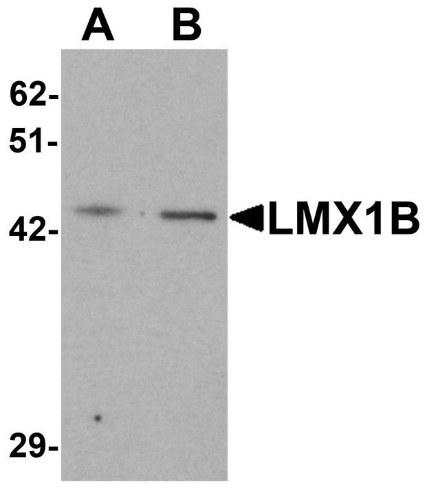 LMX1B Antibody - Western blot analysis of LMX1B in A-20 cell lysate with LMX1B antibody at (A) 1 and (B) 2 ug/ml.