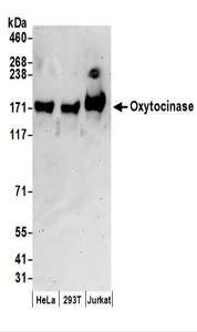 LNPEP Antibody - Detection of Human Oxytocinase by Western Blot. Samples: Whole cell lysate (50 ug) prepared using NETN buffer from HeLa, 293T, and Jurkat cells. Antibodies: Affinity purified rabbit anti-Oxytocinase antibody used for WB at 0.1 ug/ml. Detection: Chemiluminescence with an exposure time of 3 minutes.