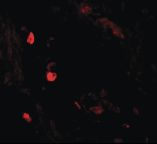 LNPEP Antibody - Immunofluorescence of LNPEP in human lung tissue with LNPEP antibody at 20 ug/ml.
