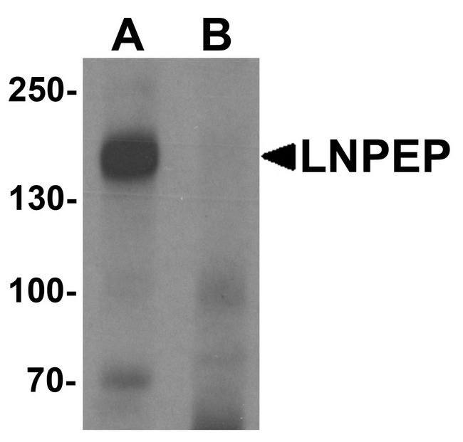 LNPEP Antibody - Western blot analysis of LNPEP in human lung tissue lysate with LNPEP antibody at 1 ug/ml in (A) the absence and (B) the presence of blocking peptide.