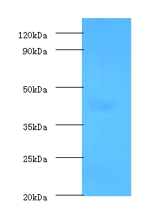 LOX / Lysyl Oxidase Antibody - Western blot of Protein-lysine 6-oxidase antibody at 2 ug/ml| with K562 whole cell lysate. Secondary: Goat polyclonal Rabbit IgG at 1:10000 dilution. Predicted band size: 47 KDa. Observed band size: 47 KDa.  This image was taken for the unconjugated form of this product. Other forms have not been tested.