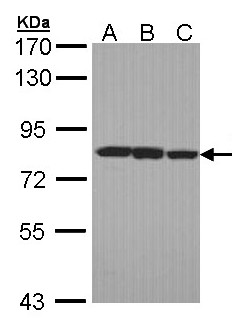 LOXL2 Antibody - Sample (30 ug of whole cell lysate). A:293T, B: A431 , C: H1299. 7.5% SDS PAGE. LOXL2 antibody diluted at 1:1000.
