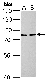 LOXL2 Antibody - LOXL2 antibody detects LOXL2 protein by Western blot analysis. A. 30 ug PC-12 whole cell lysate/extract. B. 30 ug Rat2 whole cell lysate/extract. 7.5 % SDS-PAGE. LOXL2 antibody dilution:1:1000