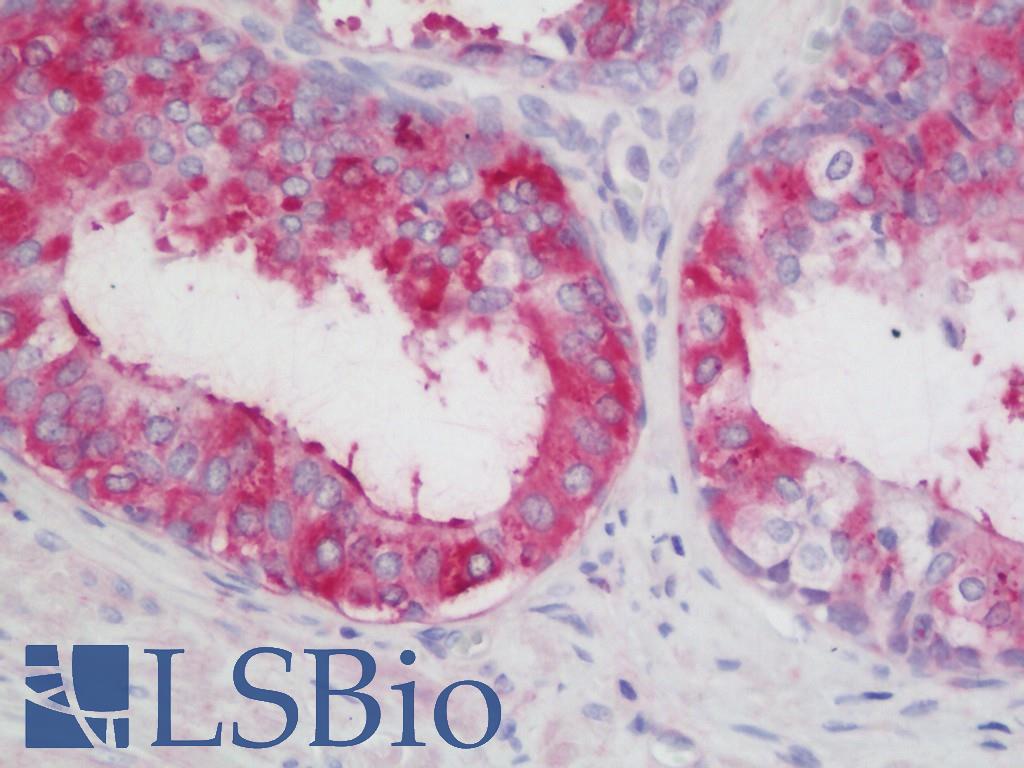 LOXL2 Antibody - Anti-LOXL2 antibody IHC staining of human prostate. Immunohistochemistry of formalin-fixed, paraffin-embedded tissue after heat-induced antigen retrieval. Antibody concentration 5 ug/ml.