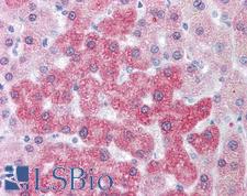 LOXL2 Antibody - Anti-LOXL2 antibody IHC of human liver. Immunohistochemistry of formalin-fixed, paraffin-embedded tissue after heat-induced antigen retrieval.