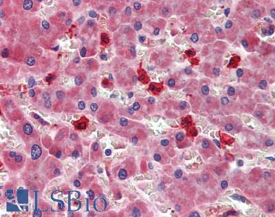 LOXL3 Antibody - Human Liver: Formalin-Fixed, Paraffin-Embedded (FFPE)