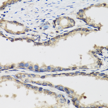 LP-PLA2 / PLA2G7 Antibody - Immunohistochemistry of paraffin-embedded human prostate.