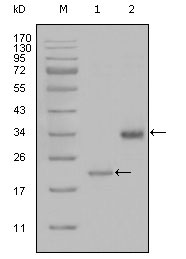 LPA / Lipoprotein a Antibody - Western blot using LPA mouse monoclonal antibody against truncated LPA-His recombinant protein (1) and truncated Trx-LPA(aa4330-4521) recombinant protein (2).