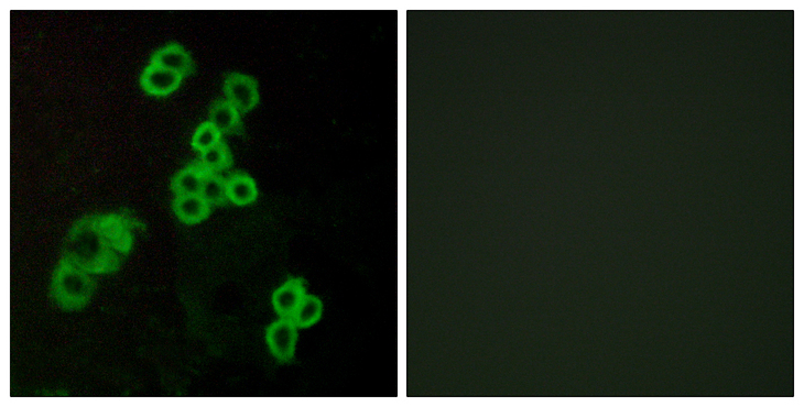 LPAR1 / LPA1 / EDG2 Antibody - Immunofluorescence analysis of MCF7 cells, using EDG2 Antibody. The picture on the right is blocked with the synthesized peptide.