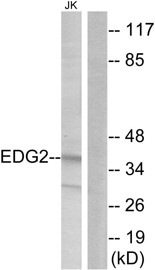 LPAR1 / LPA1 / EDG2 Antibody - Western blot analysis of lysates from Jurkat cells, using EDG2 Antibody. The lane on the right is blocked with the synthesized peptide.