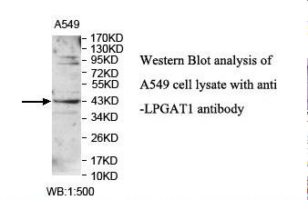 LPGAT1 Antibody