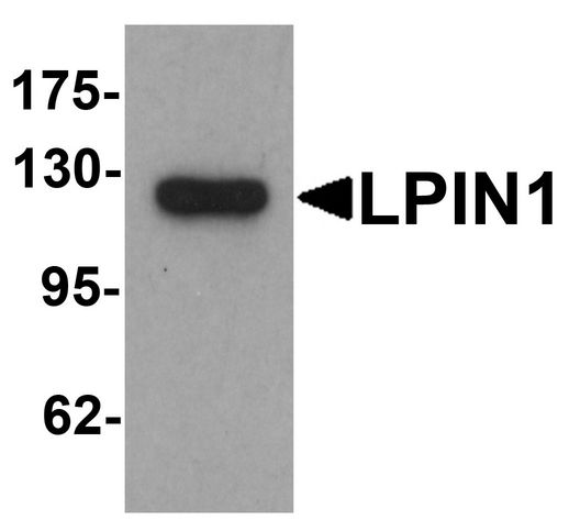 LPIN1 / Lipin 1 Antibody - Western blot analysis of LPIN1 in K562 cell lysate with LPIN1 antibody at 1 ug/ml.