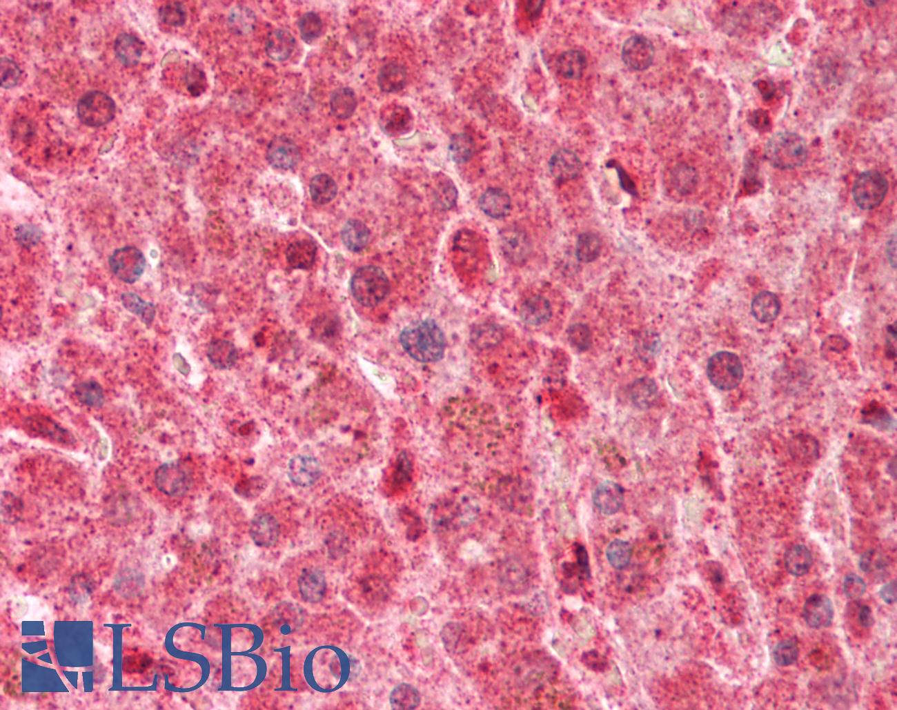 LPL / Lipoprotein Lipase Antibody - Human Liver: Formalin-Fixed, Paraffin-Embedded (FFPE).  This image was taken for the unconjugated form of this product. Other forms have not been tested.