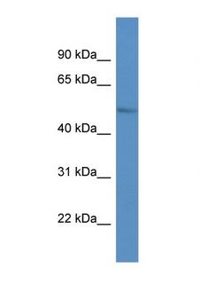 LPL / Lipoprotein Lipase Antibody - LPL / Lipoprotein Lipase antibody western blot of RPMI-8226 cell lysate. Antibody concentration 1 ug/ml.  This image was taken for the unconjugated form of this product. Other forms have not been tested.