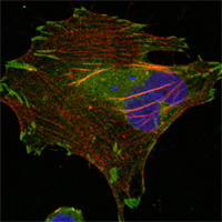lpp Antibody - Confocal immunofluorescence of HeLa cells using LPP mouse monoclonal antibody (green). Red: Actin filaments have been labeled using DY-554 phalloidin. Blue: DRAQ5 fluorescent DNA dye.