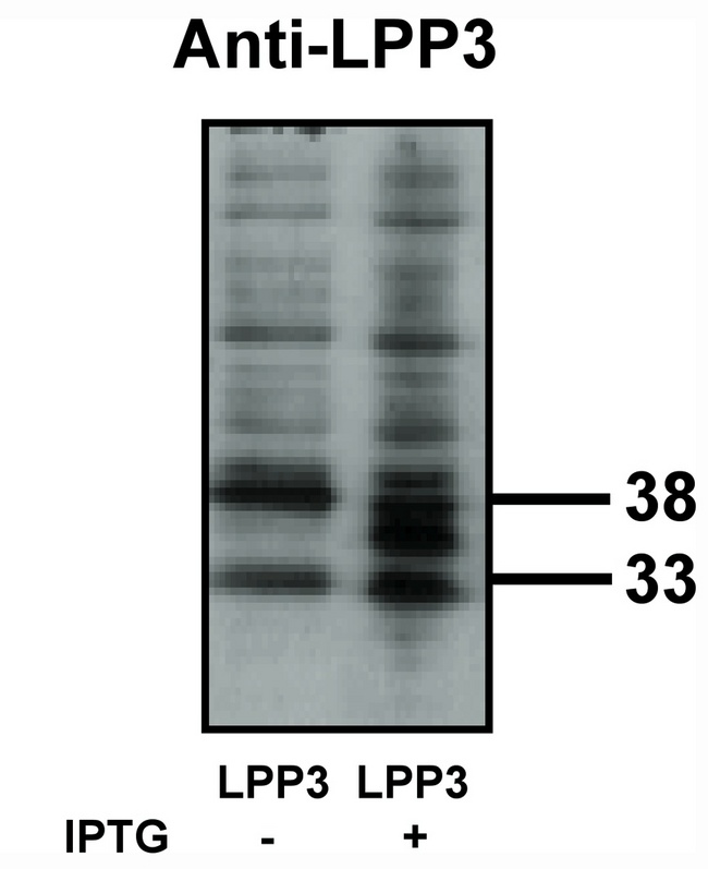 LPP3 / PPAP2B Antibody - Western blot of LPP3 antibody on bacterially expressed LPP3 protein when untreated (-) and treated with with 0.1 mM IPTG (iso propyl-beta-D- thiogalactopyranoside) (+) at a dilution of 10 ug/ml.