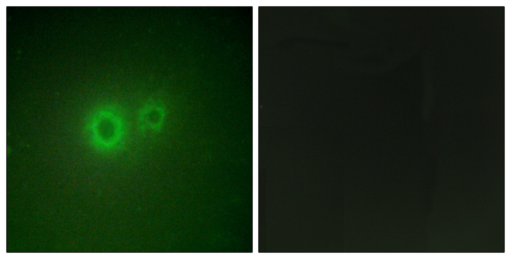 LRAT Antibody - Immunofluorescence analysis of HUVEC cells, using LRAT Antibody. The picture on the right is blocked with the synthesized peptide.