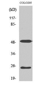 LRAT Antibody - Western blot analysis of Anti-LRAT antibody (LS-B8398, 1:1000 dilution). Lane 1: COLO205 cell line. Antibody produced band at ~25 kDa and ~50 kDa