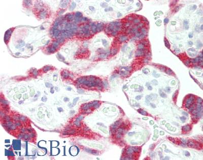 LRAT Antibody - Human Placenta: Formalin-Fixed, Paraffin-Embedded (FFPE)