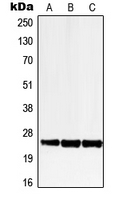 LRAT Antibody - Western blot analysis of LRAT expression in HEK293T (A); SP2/0 (B); H9C2 (C) whole cell lysates.