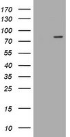 LRCH4 Antibody - HEK293T cells were transfected with the pCMV6-ENTRY control (Left lane) or pCMV6-ENTRY LRCH4 (Right lane) cDNA for 48 hrs and lysed. Equivalent amounts of cell lysates (5 ug per lane) were separated by SDS-PAGE and immunoblotted with anti-LRCH4.