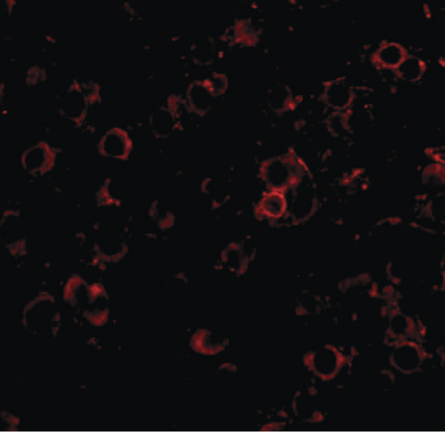 LRFN2 Antibody - Immunofluorescence of LRFN2 in mouse brain tissue with LRFN2 antibody at 20 ug/ml.