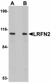 LRFN2 Antibody - Western blot of LRFN2 in rat brain lysate with LRFN2 antibody at (A) 1 and (B) 2 ug/ml. Below: Immunohistochemistry of LRFN2 in mouse brain tissue with LRFN2 antibody at 2.5 ug/ml.