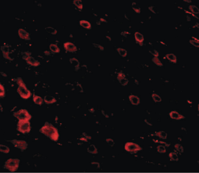 LRFN3 Antibody - Immunofluorescence of LRFN3 in mouse brain tissue with LRFN3 antibody at 20 ug/ml.