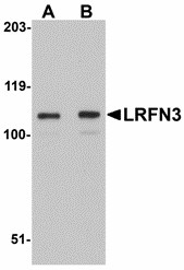 LRFN3 Antibody - Western blot of LRFN3 in K562 lysate with LRFN3 antibody at (A) 1 and (B) 2 ug/ml. 