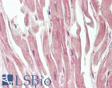 LRIG2 Antibody - Human Heart: Formalin-Fixed, Paraffin-Embedded (FFPE)