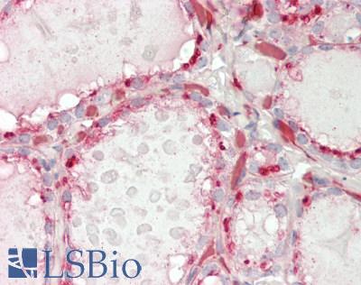 LRIG2 Antibody - Human Thyroid: Formalin-Fixed, Paraffin-Embedded (FFPE)