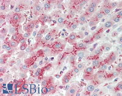 LRIG2 Antibody - Human Liver: Formalin-Fixed, Paraffin-Embedded (FFPE), at a concentration of 5 ug/ml. 