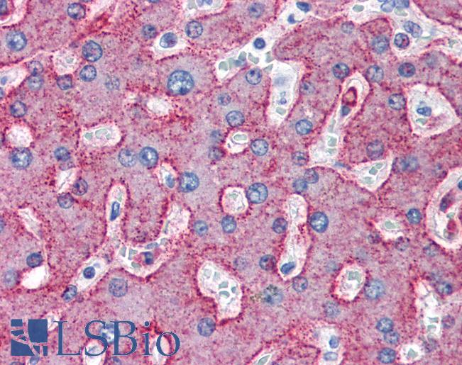 LRP1 / CD91 Antibody - Anti-LRP1 / Low Density LRP antibody IHC of human liver. Immunohistochemistry of formalin-fixed, paraffin-embedded tissue after heat-induced antigen retrieval. Antibody concentration 10 ug/ml.